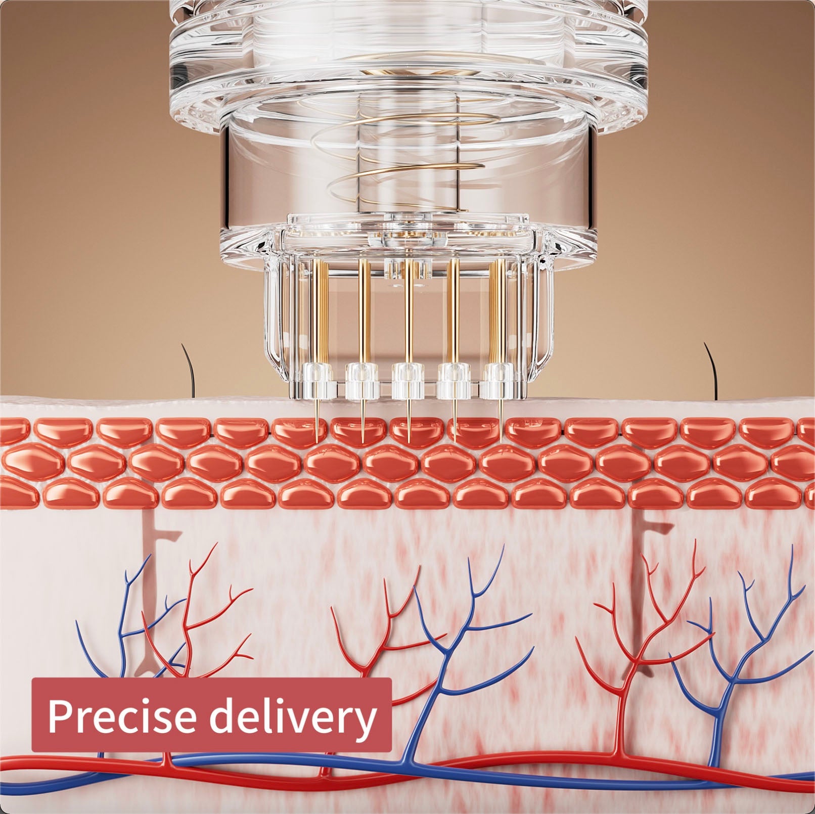 micro infusion microneedle