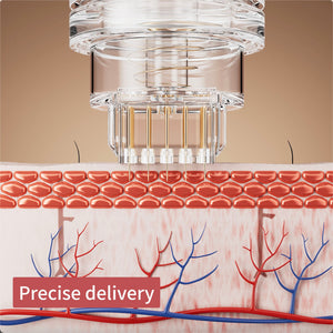 micro infusion microneedle